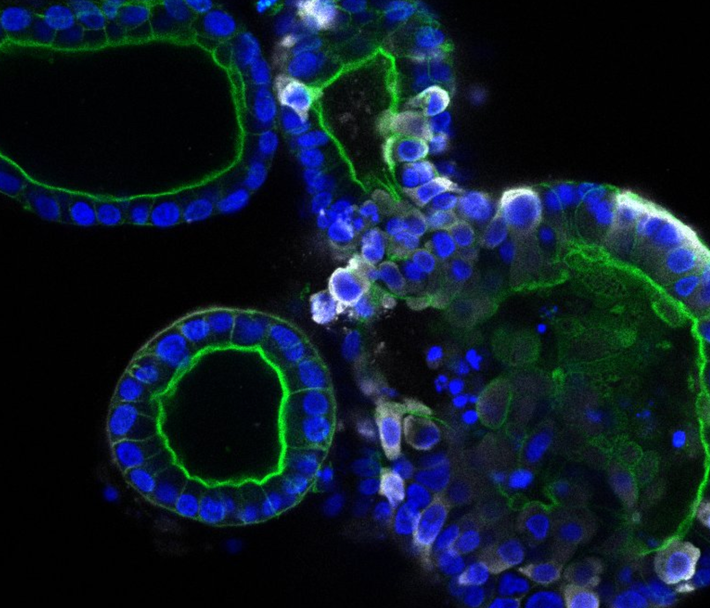 SARS-CoV-2-infects-gut-cells-ft-img-2-710x608-1.png
